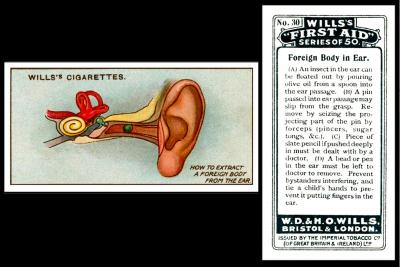 W675-112B : W62-79B : W61A [tobacco : UK] W.D. & H.O. Wills "First Aid" (April 1913) 30/50